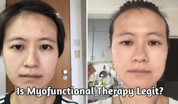 Is Myofunctional Therapy Legit