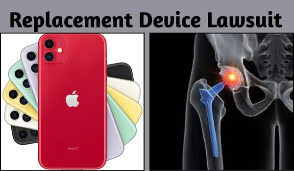 Replacement Device Lawsuit